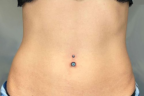 Пирсинг пупка Пирсинг пупка