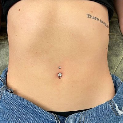 Прокол пупка